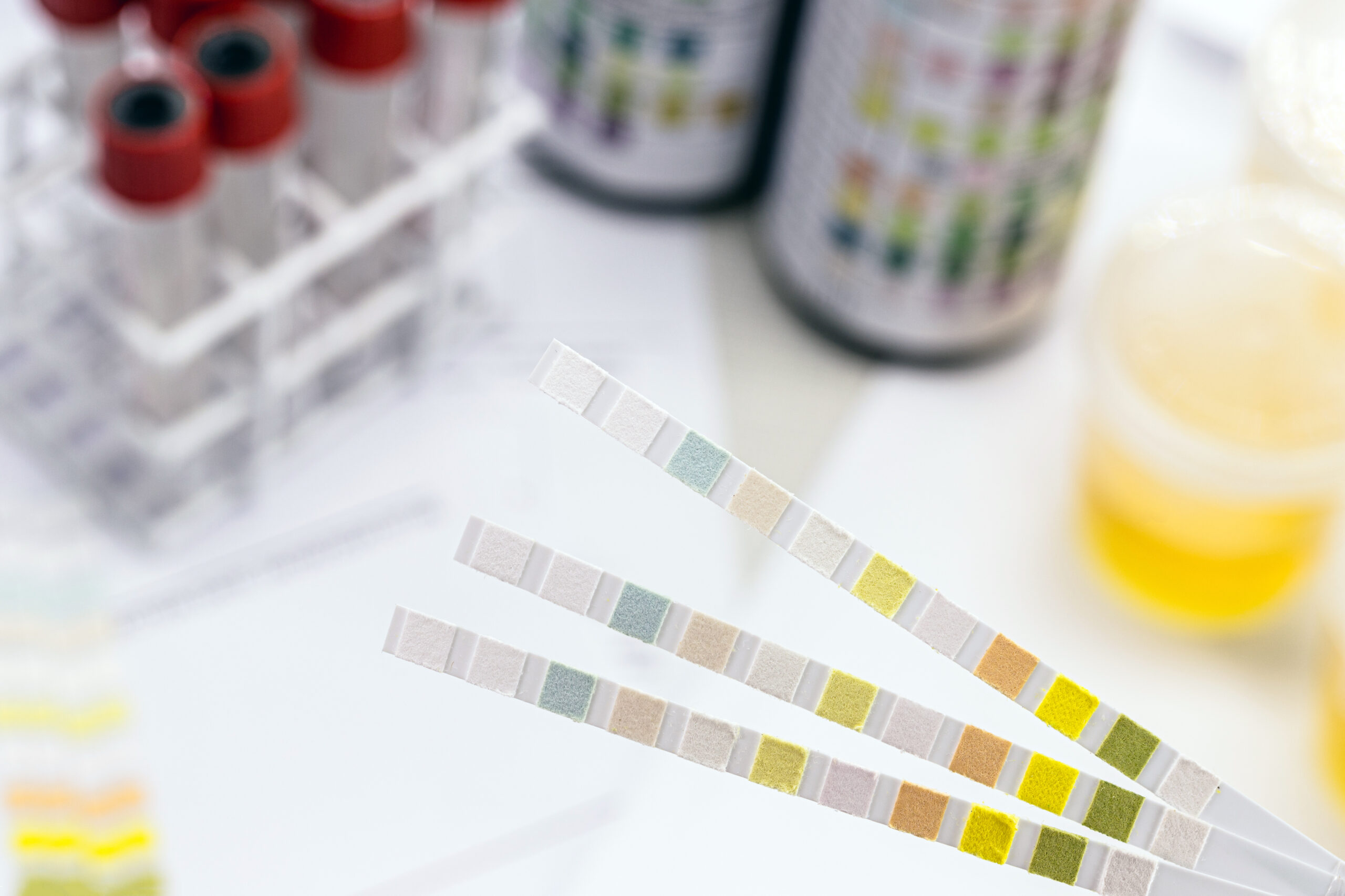 how utis are diagnosed